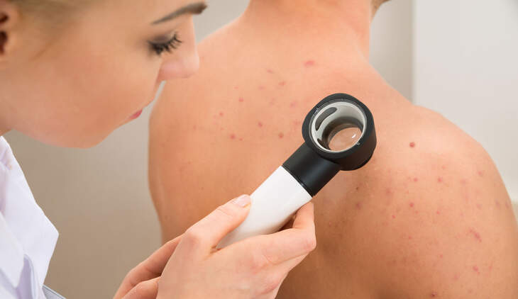 Diese 8 Hautkrankheiten sollten Sie kennen | Women&rsquo;s Health